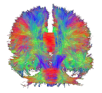 Nureoscan of Dr. Dar Meshi's Brain